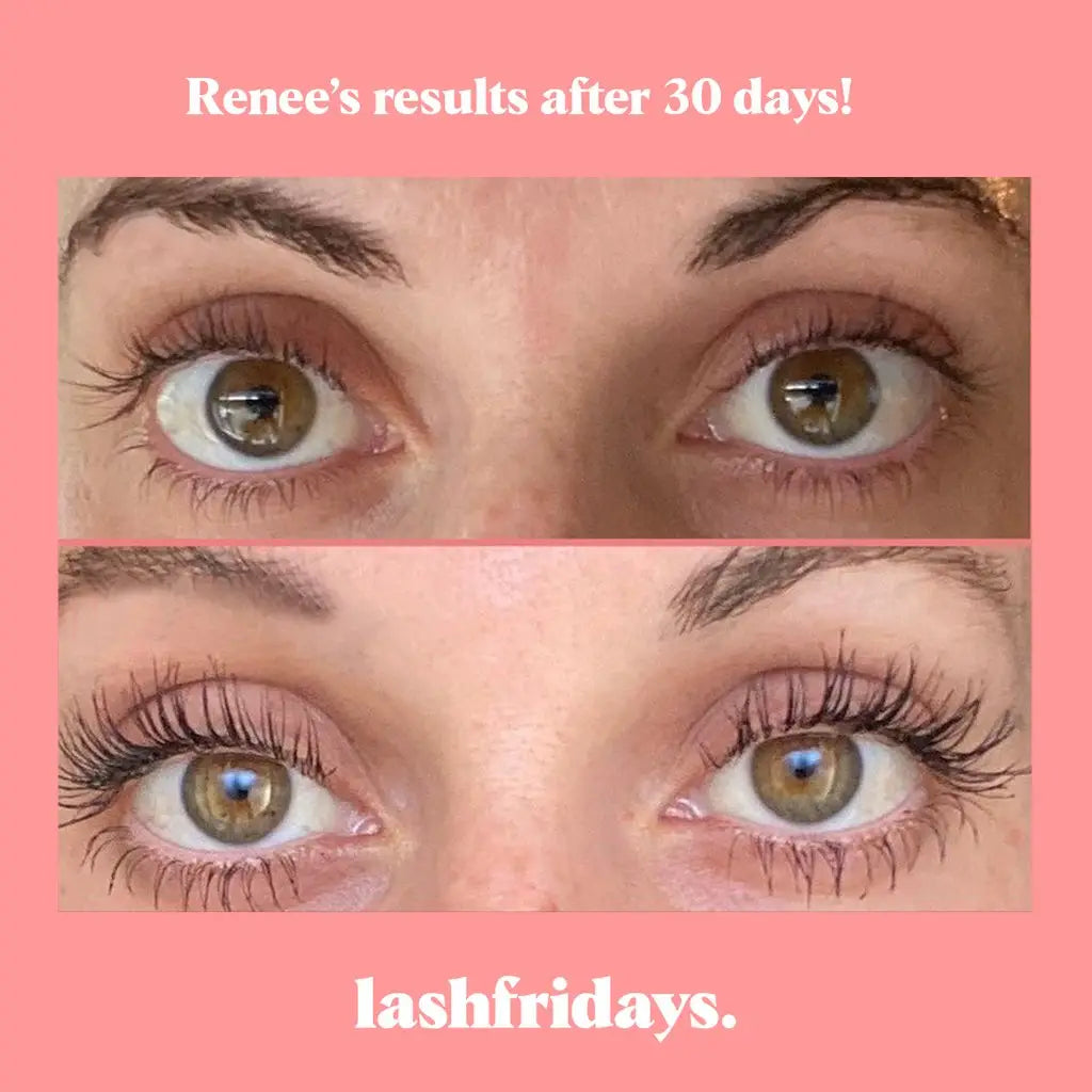 Eyelash Growth Serum